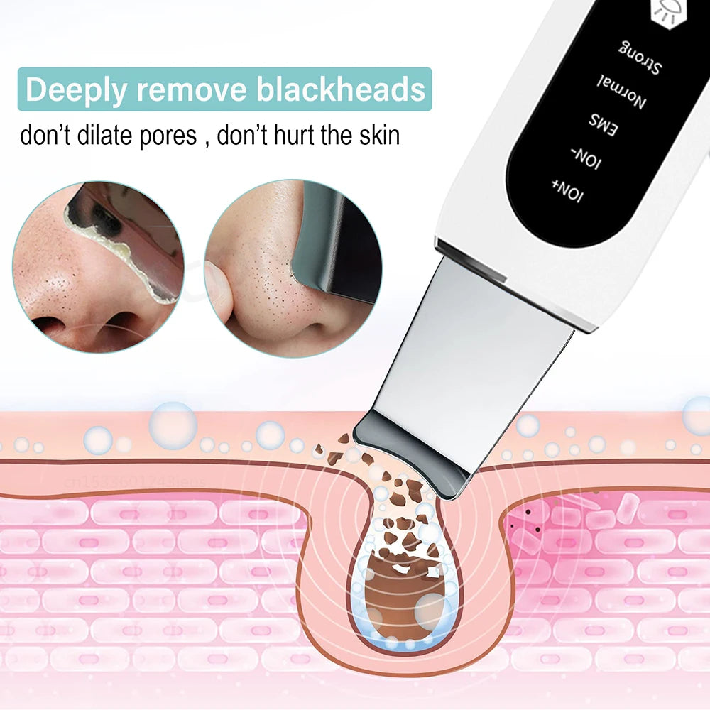 Ultrasonic Skin Scrubber – Deep Facial Cleaner & Blackhead Remover with Lifting Mode