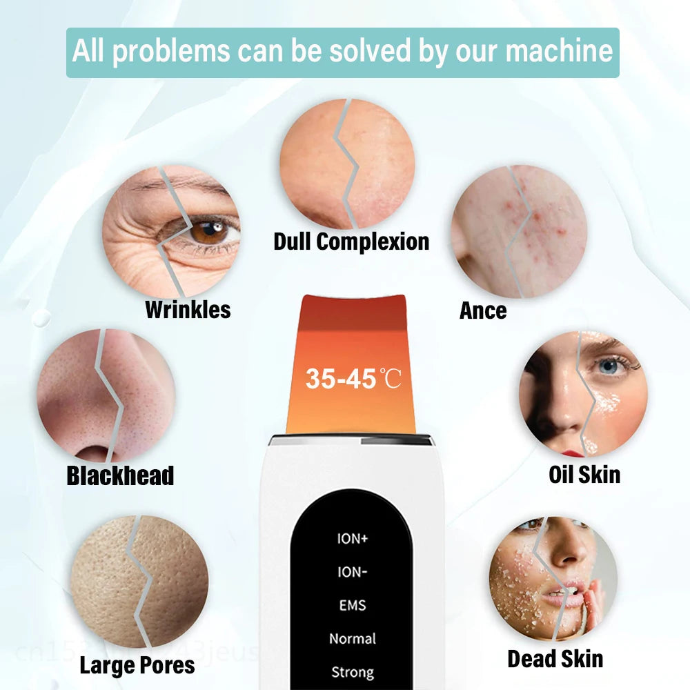 Ultrasonic Skin Scrubber – Deep Facial Cleaner & Blackhead Remover with Lifting Mode